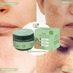 Blem Dr. The Ultimate Pekas Cream - 15g - Image 7