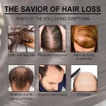 EELHOE Rosemary Oil for Hair Growth - Image 7