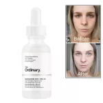 The Ordinary 3 IN 1 Set - 30ml - Image 5