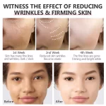 Vibrant Glamour Double Retinol Serum Anti-aging - 30ml - Image 5