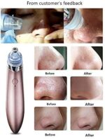 Acne pore cleaner Vacuum negative pressure easy pimple removing - XN-8030 - Image 2