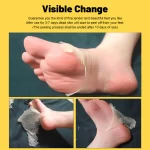 Aichun Beauty Banana Foot Peeling Mask - 40g - Image 2