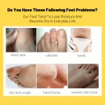 Aichun Beauty Banana Foot Peeling Mask - 40g - Image 5