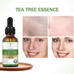 Aichun Beauty Moisturizing Whitening Tea Tree Oil Face Serum - 30ml - Image 3