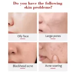 Aichun Beauty Papaya Soft Clean Peeling Gel Face & Body - 100g - Image 6