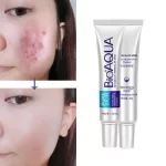Bioaqua face cream skin care anti acne treatment cream 30g -100% ORIGINAL