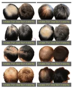 Dexe Hair Building Fibers Black - 22g - Image 5