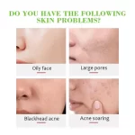 Disaar Aloe Vera Soothing & Moisturizing Gel - 300ml - Image 5