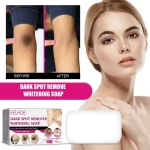 EELHOE Dark Spot Remover Whitening Soap - 100g - Image 3