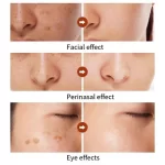 Hymey's Nicotinamide Anti Freckle Face Serum - 30ml - Image 5