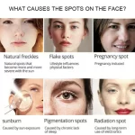 Hymey's Nicotinamide Anti Freckle Face Serum - 30ml - Image 6