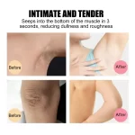 EELHOE Dark Spot Remover Whitening Soap - 100g - Image 2