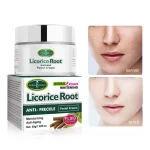 Aichun Beauty Licorice Root Anti-Freckle Facial Cream - 50g - Image 2