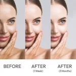 Kojie San Skin Lightening Kojic Acid Soap 3 Bars 100gm × 2 Pcs (Offer) - Image 7