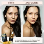 BMRS Retinol Serum - 30ml - Image 5