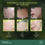 Anua Heartleaf 77% Soothing Toner - 250ml - Image 8