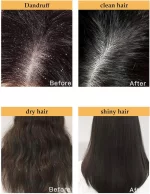 Maxfit Hair Growth Sakura Japanese Shampoo - 300ml - Image 4