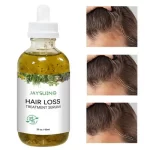 Jaysuing Hair Loss Treatment Serum - 60ml - Image 3