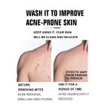 Roushun 2 in 1 Honey + Vitamin C Shower Bath - 1300ml - Image 3