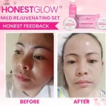 HonestGlow Facial Set Mild Rejuvenating Set - Image 4