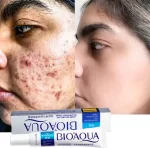 Bioaqua Acne Removing & Rejuvenating Cream - 30g - Image 2