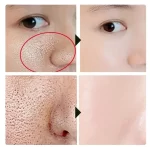 Bioaqua Acne Removing & Rejuvenating Cream - 30g - Image 3