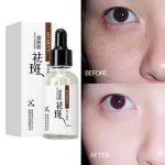 Hymey's Nicotinamide Anti Freckle Face Serum - 30ml