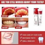 Yayashi SP-4 Ultra + Whitening Probiotic Toothpaste - 120g - Image 9