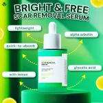Bright & Free Scar Removal Serum - 30ml - Image 3