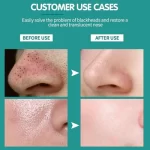 Disunie Removes Blackhead Nose Mask Bamboo Charcoal - 10Pcs - Image 11