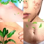 Bright & Free Scar Removal Serum - 30ml - Image 7