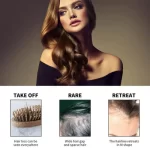 Jaysuing Hair Loss Treatment Serum - 60ml - Image 8