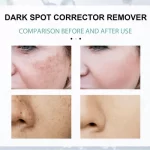 EELHOE Dark Spot Corrector - 30g - Image 5