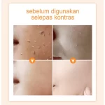 Gmeelan Orange Exfoliating Whitening Gel - 50g - Image 3