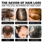 Jaysuing Anti-Hair Loss Ginger Shampoo Bar - Image 3