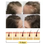 Jaysuing Anti-Hair Loss Ginger Shampoo Bar - Image 7