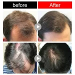 Jaysuing Anti-Hair Loss Ginger Shampoo Bar - Image 8