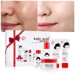 Kojic Acid Whitening Skin Care Set - Image 6