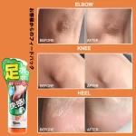 Orange Oil Foot Peeling Spray - 110ml - Image 5