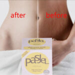 Pasjel Cream For Stretch Marks And Scar Removal Cream 50g - Image 3