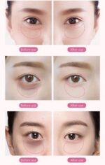 Rose Berry Roselle Gel Eye Mask - 60pcs - Image 4