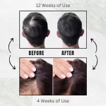 Rosemary Oil for Hair Growth - Rosemary Barij - Image 6