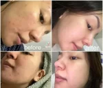 Rosmar Instant Whitening Bleaching Whipped Scrub Spf 60 - 300gm - Image 4