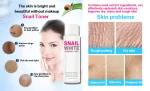 Roushun Snail White Essential Toner - 120ml - Image 3