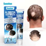 Sumifun Alopecia hair growth cream - 20g