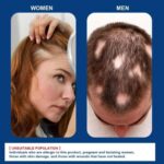 Sumifun Alopecia hair growth cream - 20g - Image 4