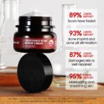 Vibrant glamour crocodile acne scar removal cream - 30g - Image 2