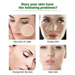 Aichun Beauty Acocado Facial Mask - 3pcs - Image 6