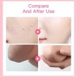 Aichun Beauty Strawberry Whitening Skin Peeling Gel Face & Body - 100g - Image 4