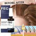 FEG Hair Growth Spray Prevent Hair Loss - 50ml - Image 9